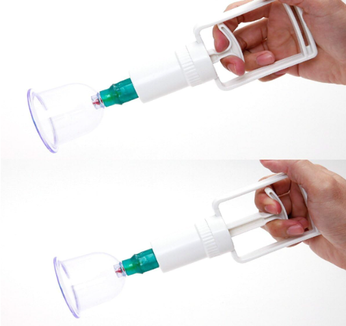 حجامة إسلامية طبية لامتصاص السموم