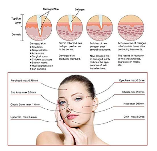 ديرما بن دكتور بن | derma pen dr pen